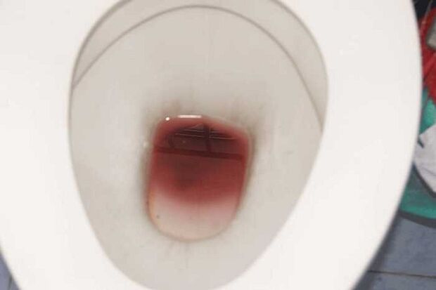 Erkennen von Männern, wenn sie erregt sind